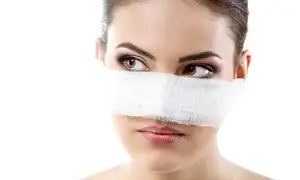 اسپلینت بینی چیست؟ نحوه استفاده و مزایای آن