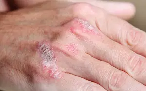 علل شایع عارضه های پوستی