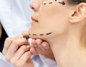 لیفت صورت بهتر است با تزریق چربی