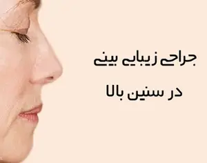 عمل زیبایی بینی در 60 سالگی