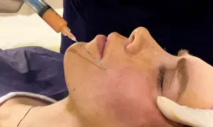 عوارض تزریق چربی به صورت