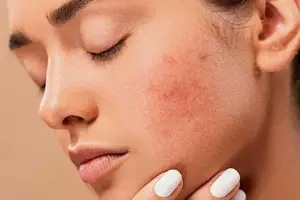 معرفی درمانهای نوین برای بهبود عارضههای پوستی رایج
