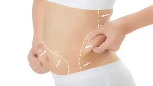 مراقبت های بعد از لیپوماتیک چگونه است؟ + شرایط بعد از عمل لیپوماتیک
