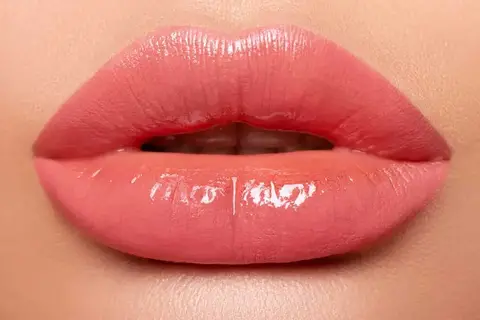 بهترین نوع تزریق ژل لب روسی طبیعی برای فرم‌دهی لب
