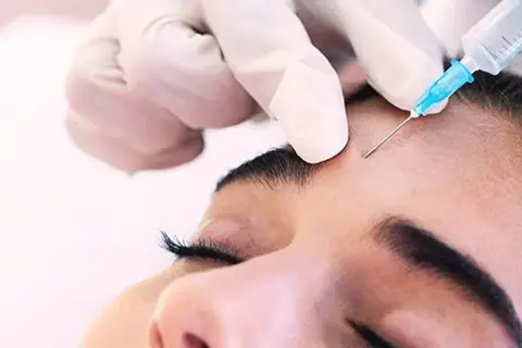 همه چیز درباره تزریق بوتاکس صورت + ماندگاری و قیمت