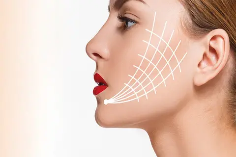 هزینه لیفت صورت​ در تهران چقدر است؟