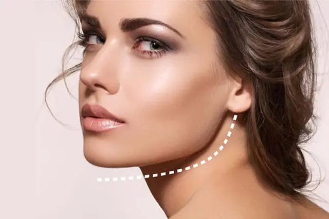 شایع ترین عوارض زاویه سازی صورت و نحوه درمان هرکدام به چه صورت است ؟