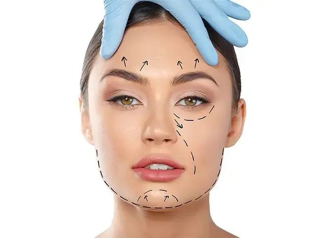 عوارض عمل لیفت صورت چیست؟