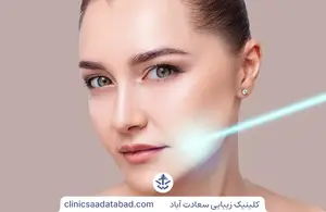 اندولیفت (افرودیت)
