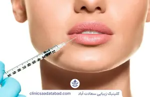 تزریق چربی به لب