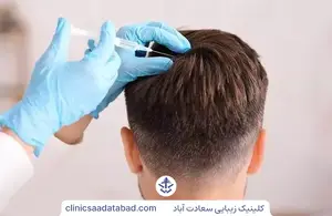 کاشت مو