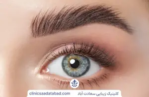کاشت ابرو