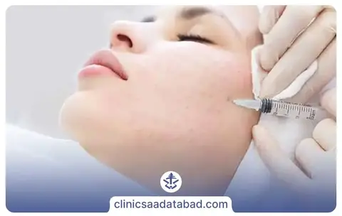 مزوتراپی صورت