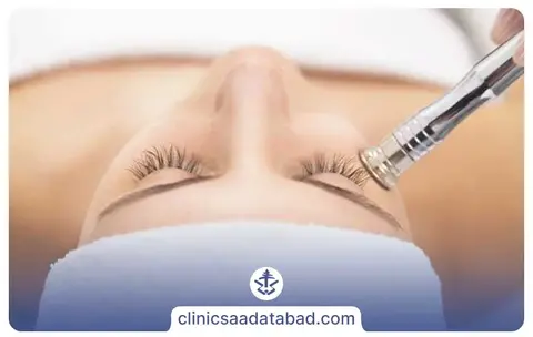 نحوه تاثيرميكرودرم بر پوست