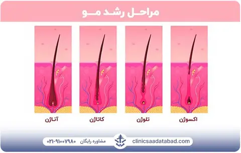 رشد مو بعد از کاشت مو