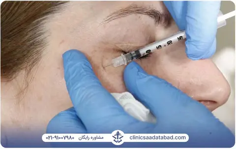 تزریق بوتاکس