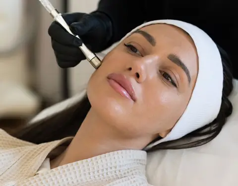 میکرودرم ابریژن چیست و مزایای آن
