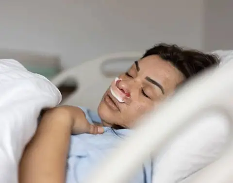 نحوه صحیح خوابیدن بعد از عمل بینی