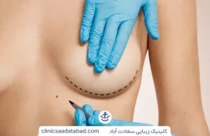 تزریق چربی به سینه