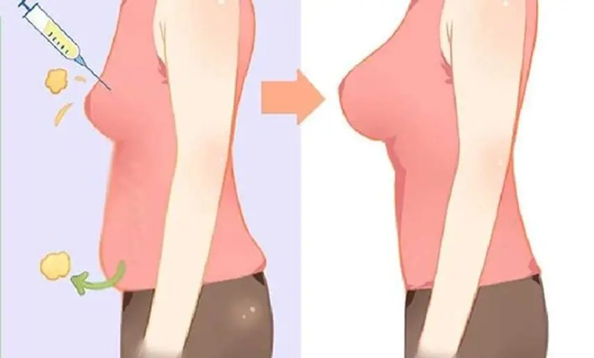 مراقبت‌های بعد از تزریق چربی برای زیبایی سینه