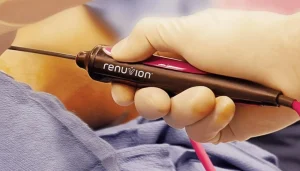 دستگاه رنوویون برای لیفت پوست