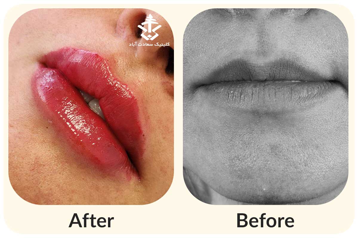 IMG_015BB6-97D8BF-63C36D-BD7147-1F9355-32E499