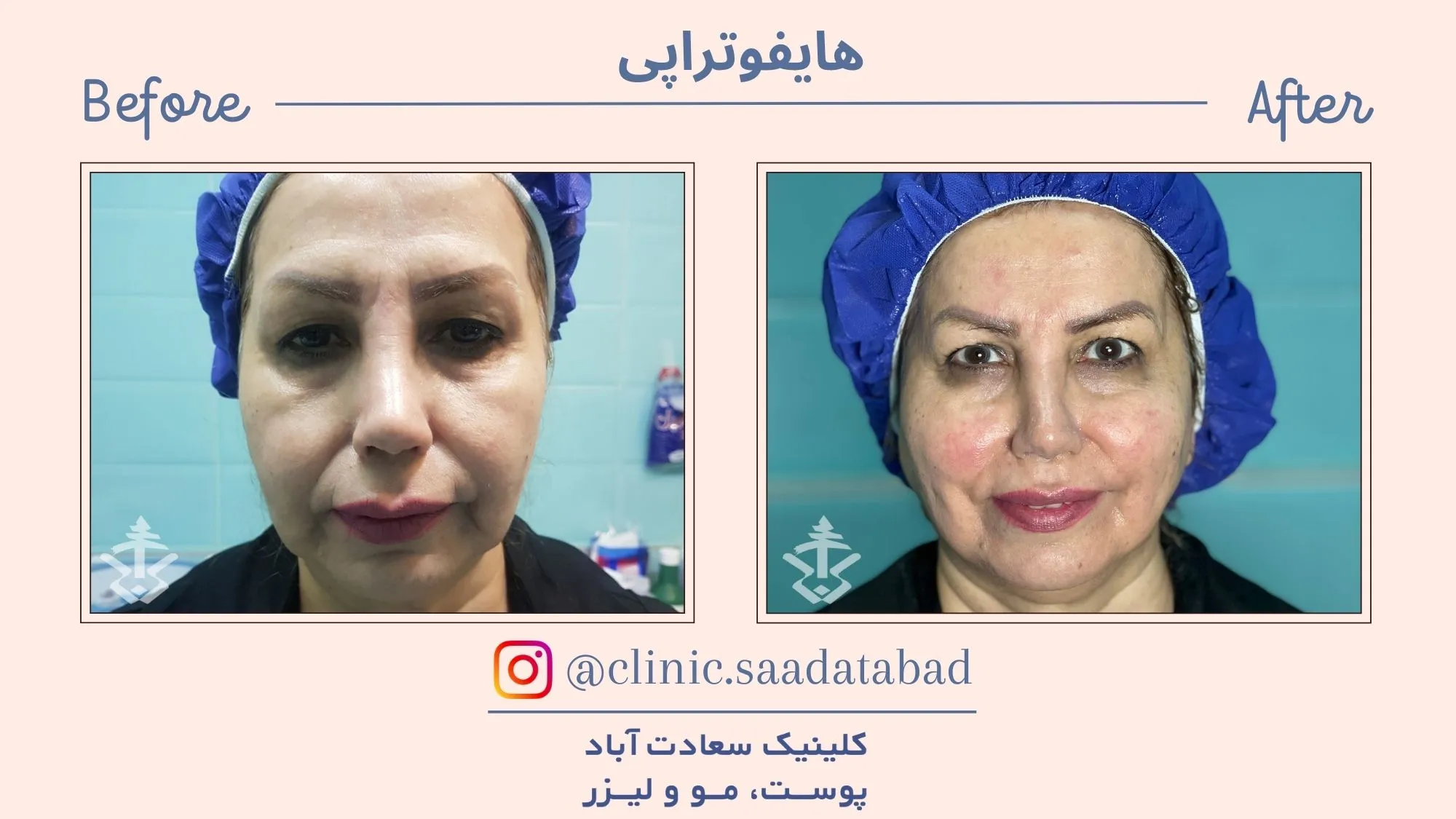 IMG_03955F-FD967A-29126E-C2D6FC-AA6A1D-89EE19-_1_