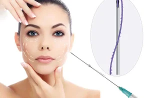 نخ کاگ چیست