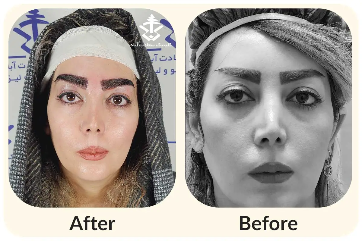 IMG_0CF7C6-C9B6F5-07C1A2-F38C12-DB6BBB-A350FB