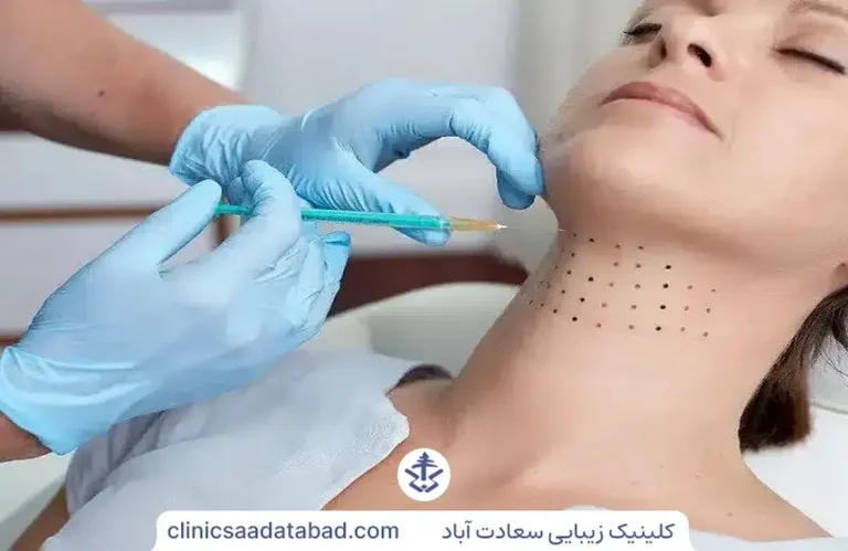 مزوتراپی غبغب