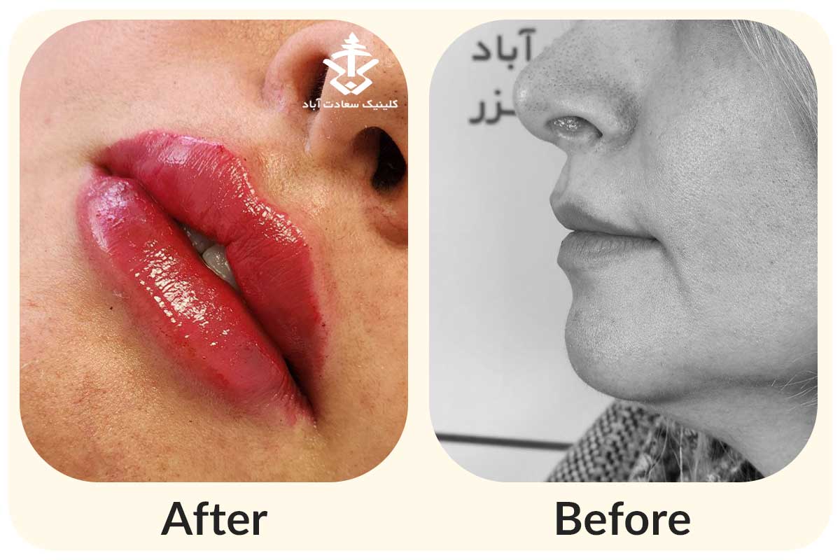 IMG_121B43-D71D4C-6B1F21-4BDFD1-749E6B-0C214B