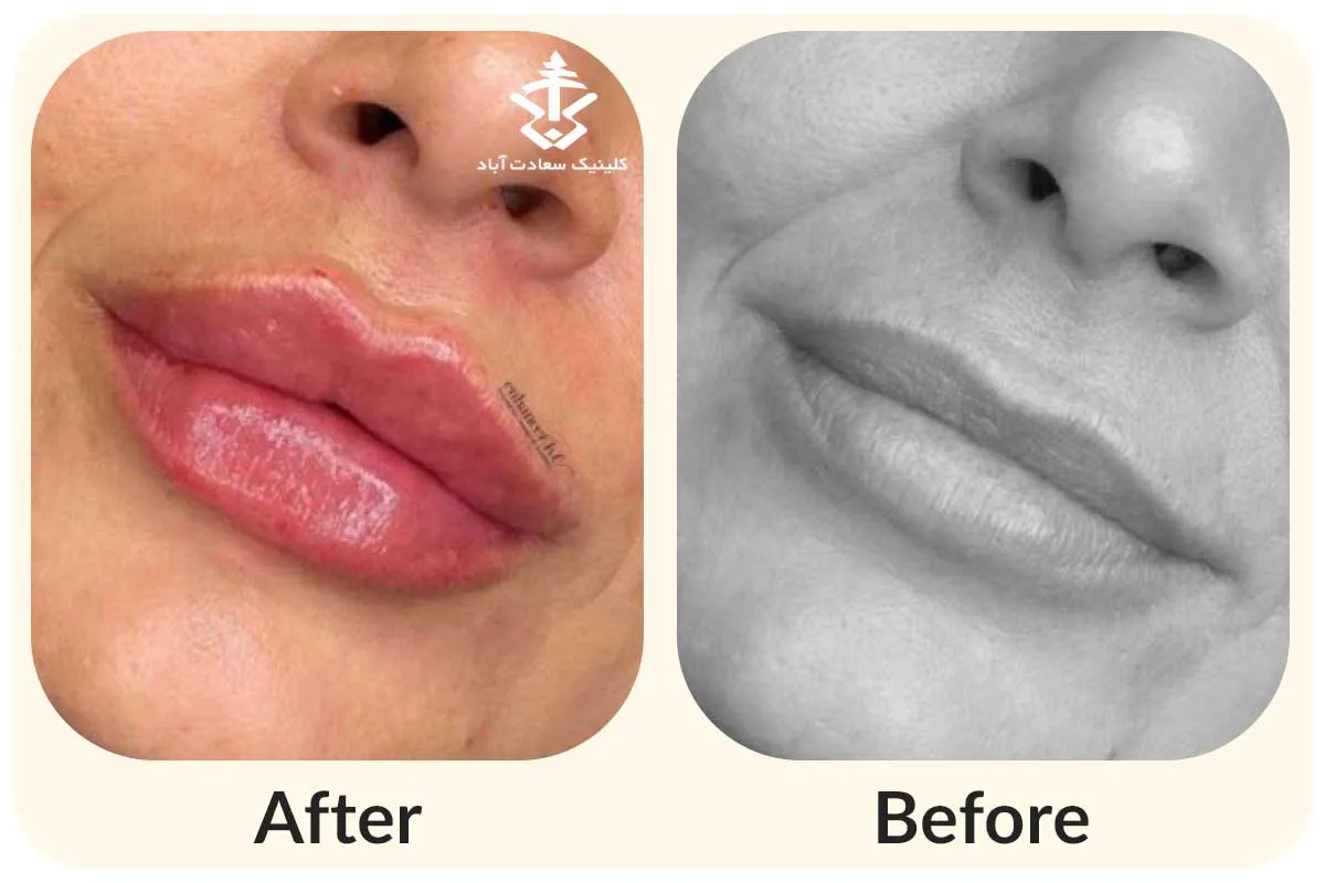 IMG_13B6EA-1A82B2-91911E-1A0D21-4DD933-647E26