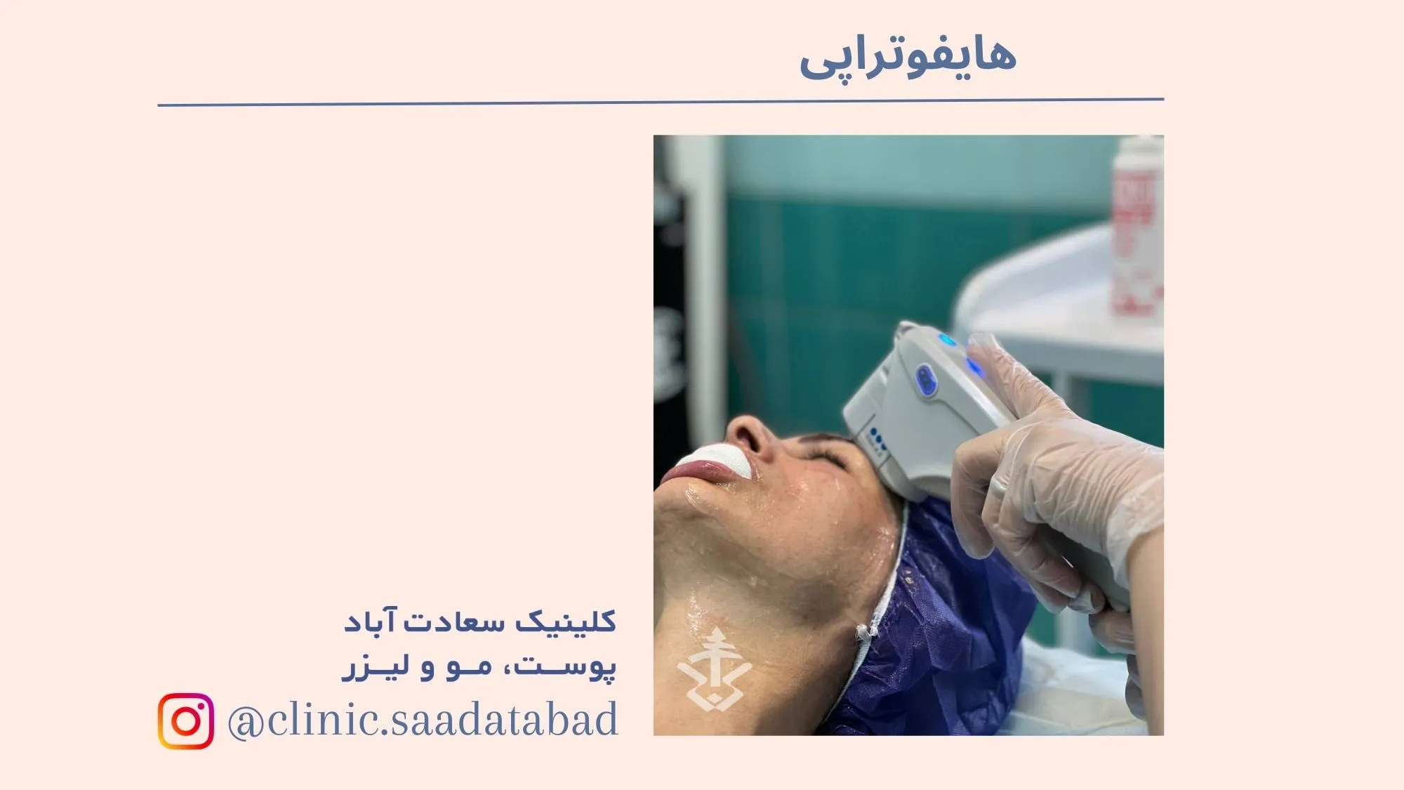 IMG_140A1D-457E62-D25EB1-7C4F0C-9DC69F-F935D5_1