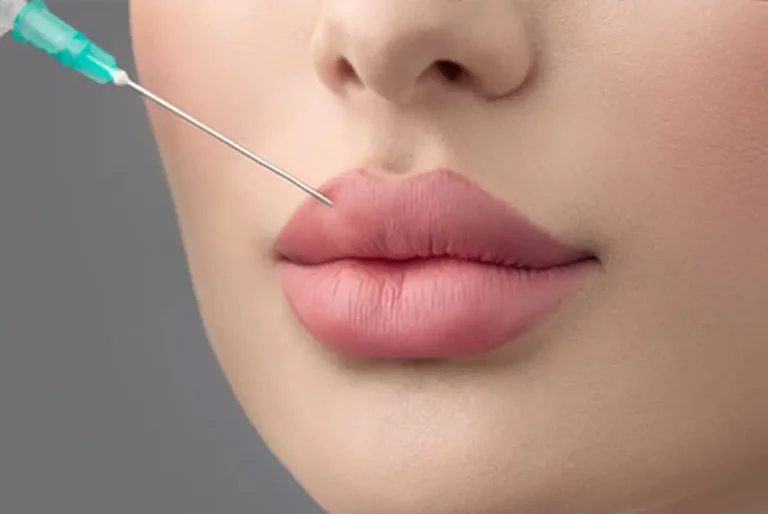 ورم بعد از تزریق ژل