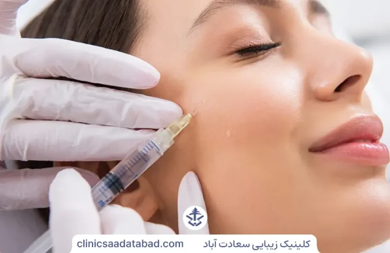 تزریق ژل صورت
