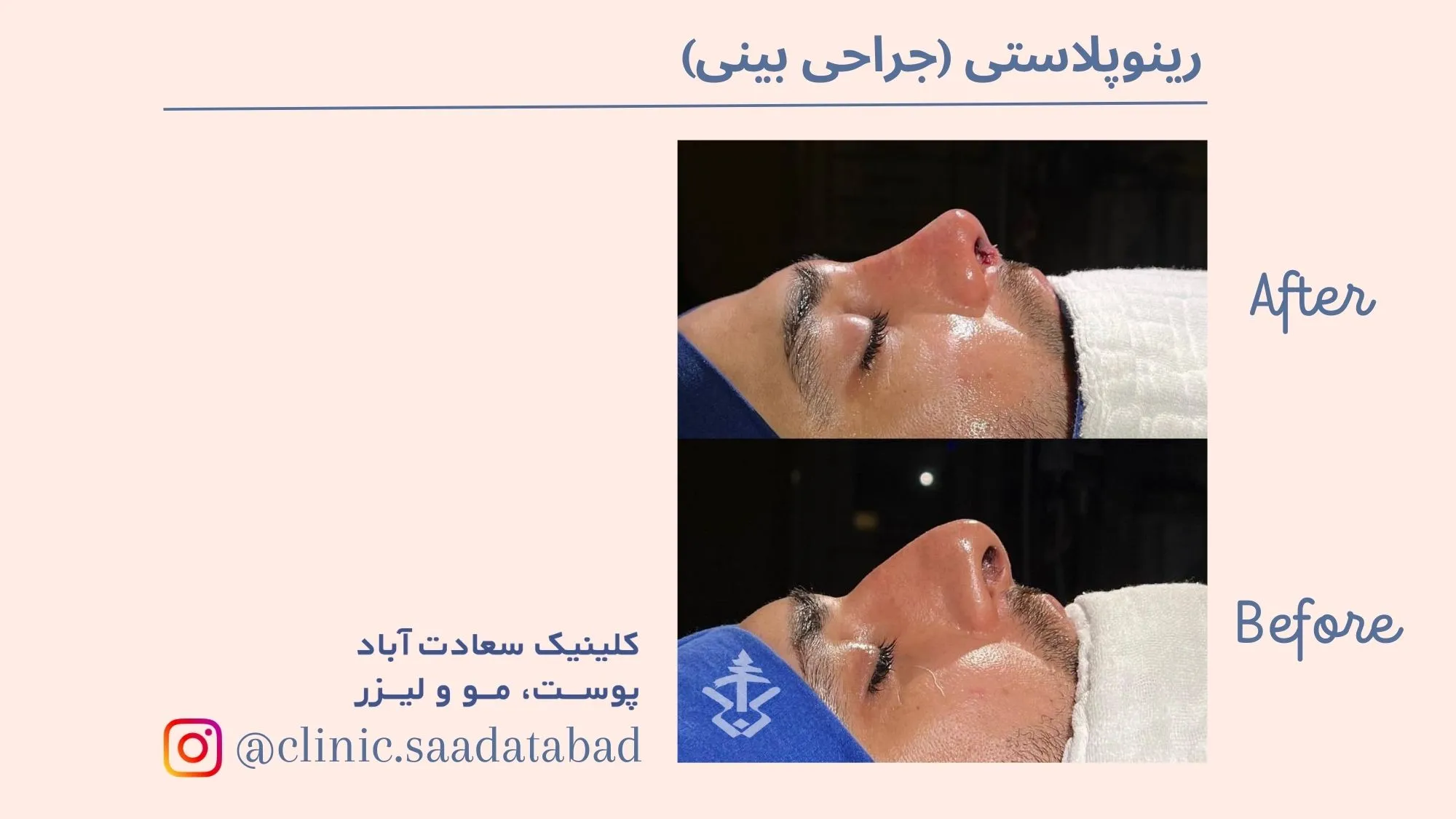 IMG_23B10F-BC3D3D-6BB99D-D64387-A3E4B0-C6A709