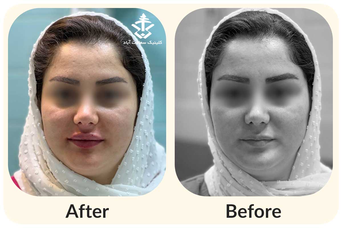 IMG_24C6C6-DC4A53-3DB254-A455A7-8364D2-A306B0