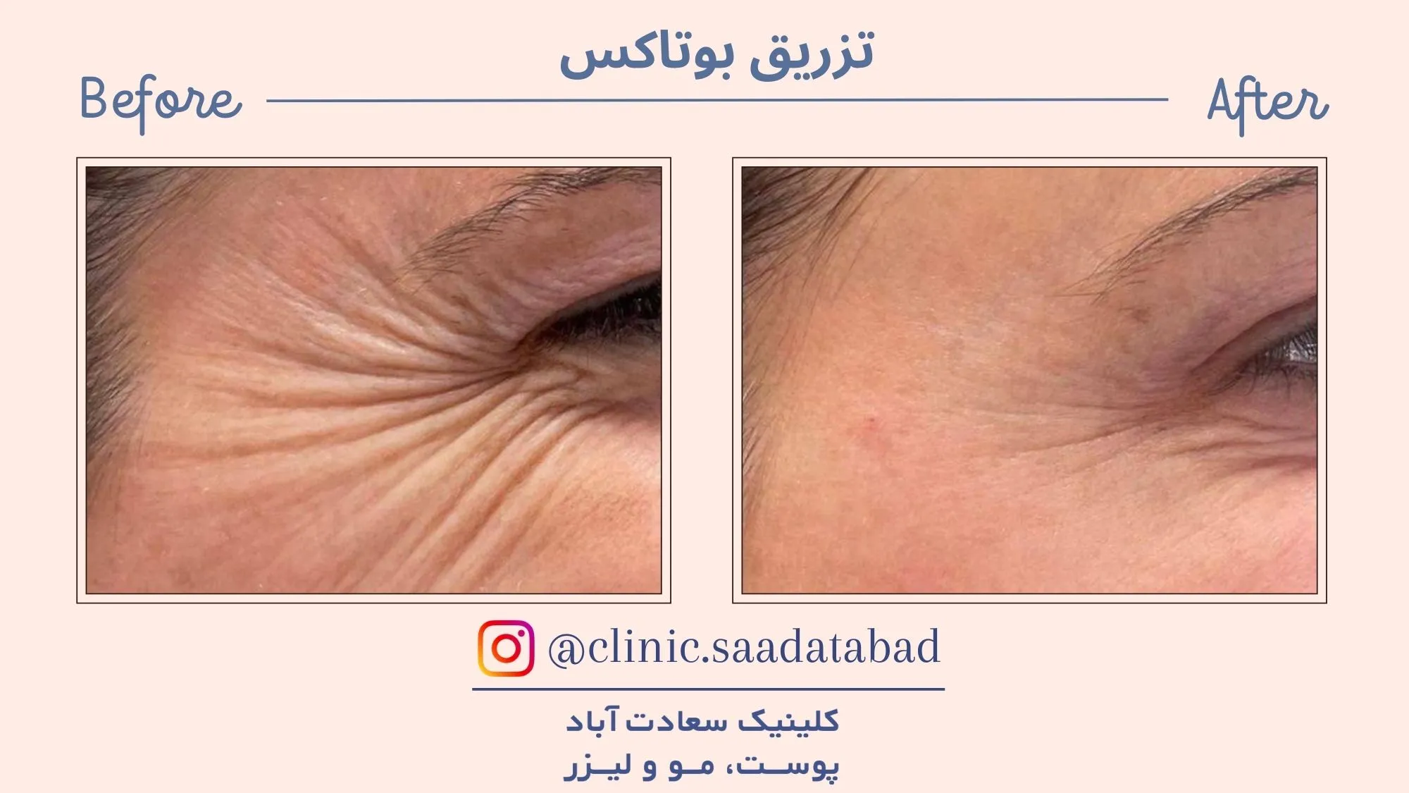 IMG_2B3755-EA357C-3B5864-7FB16C-E862E2-5D5CDE