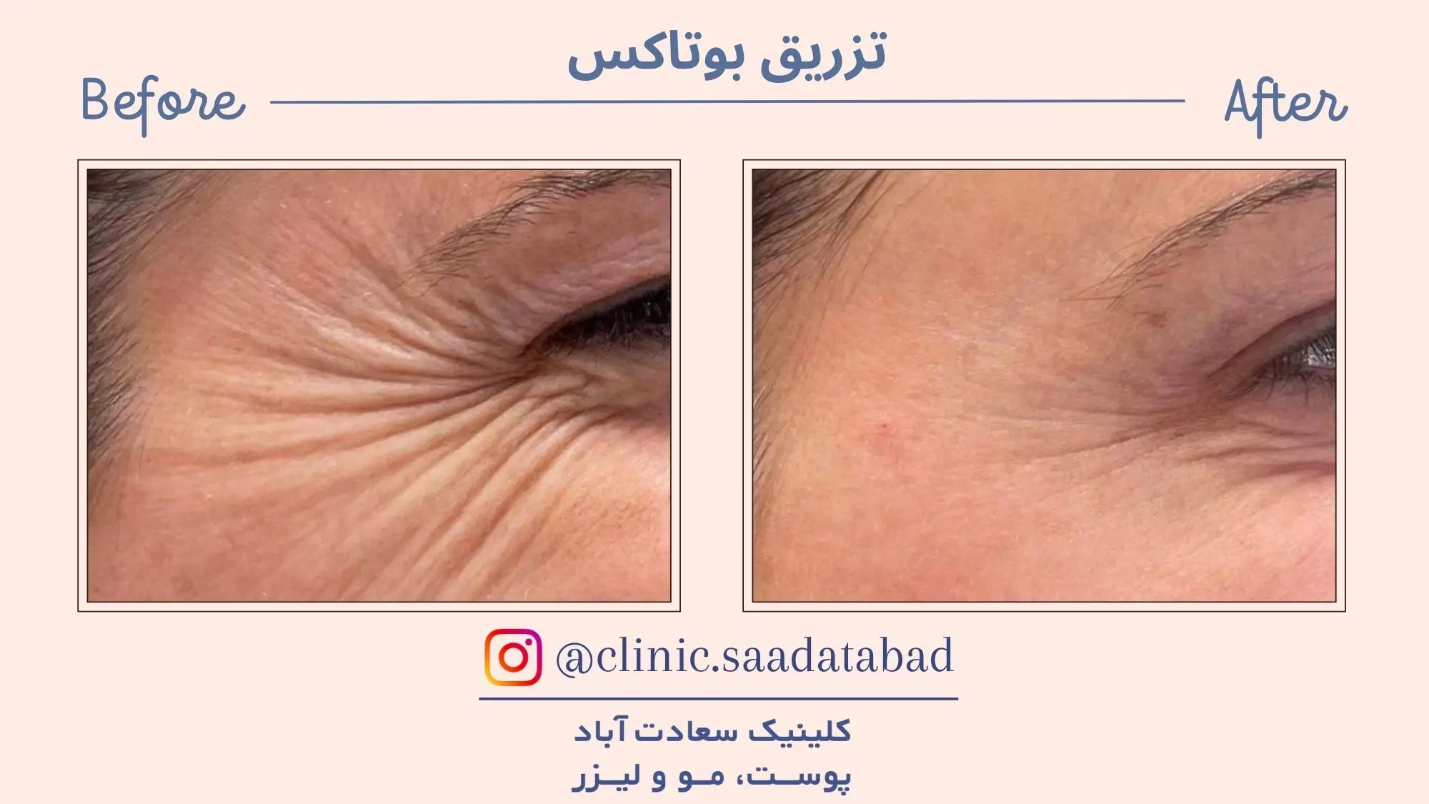 IMG_2B3755-EA357C-3B5864-7FB16C-E862E2-5D5CDE