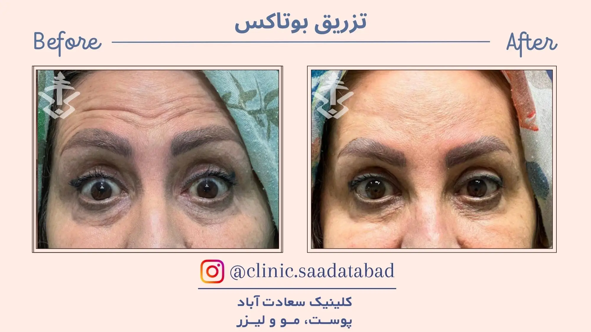 IMG_2B5DB3-ABC5FE-D91958-22EA67-B7468F-A9AEA8