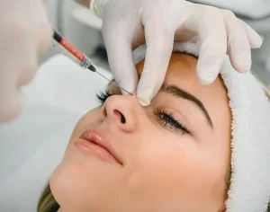 ماندگاری فیلر بینی