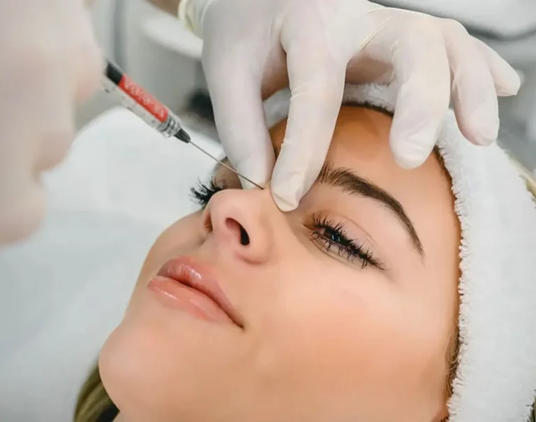 ماندگاری فیلر بینی