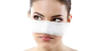 اسپلینت بینی