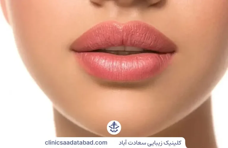 ژل لب قلوه ای