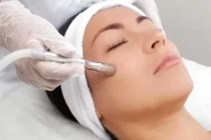 لیزر، میکرودرم ابریژن یا PRP