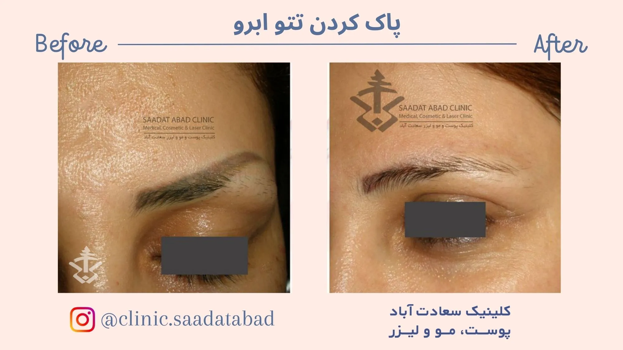 IMG_4DA2D4-104965-8043FB-1C9A43-54E905-B79C6D