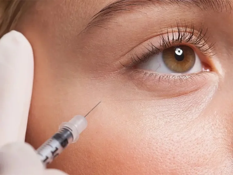 عوارض فيلر زير چشم