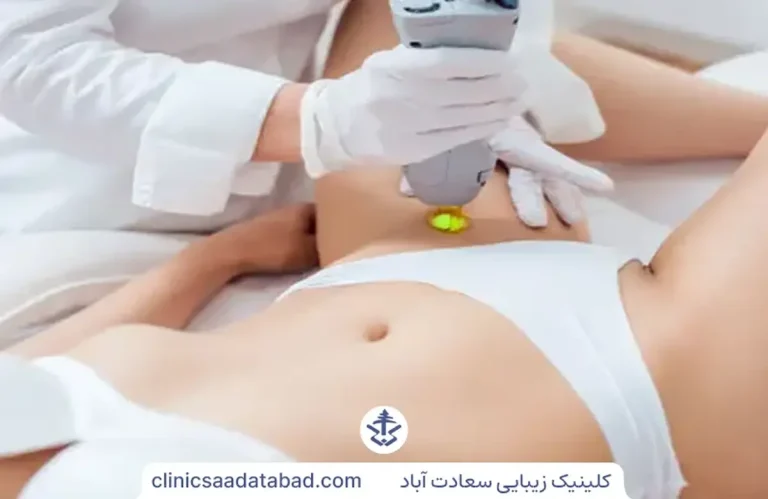 لیزر موهای زائد ناحیه ی بیکینی یا واژن