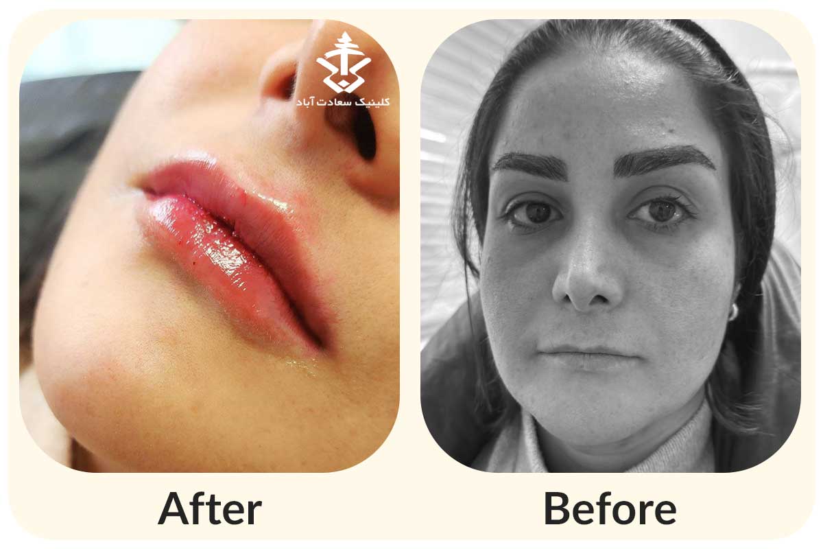 IMG_602491-B4197D-363F75-0FF7F5-60D113-D0D21B