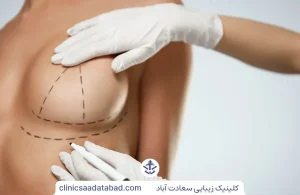 پروتز و لیفت سینه